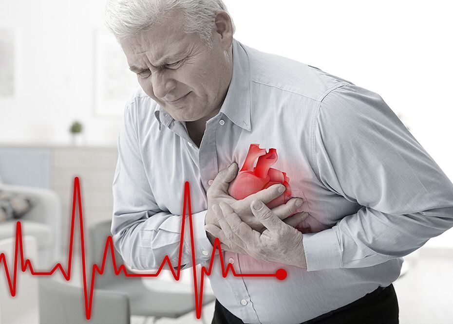 leczenie chorób serca za pomocą Cardione